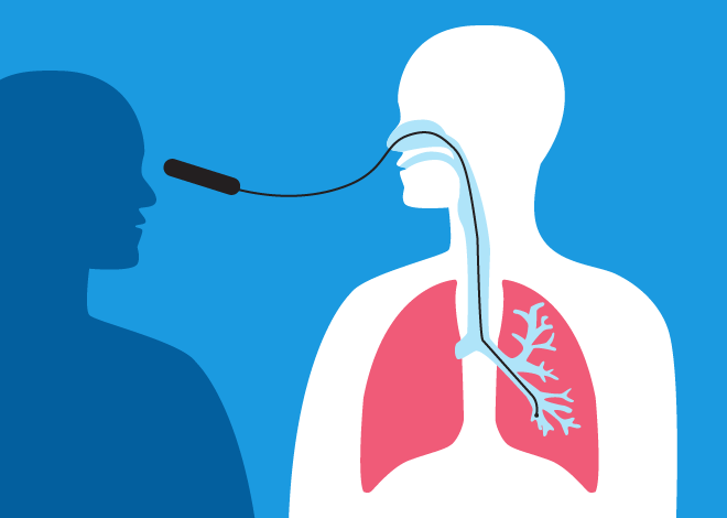Bronchoscopy